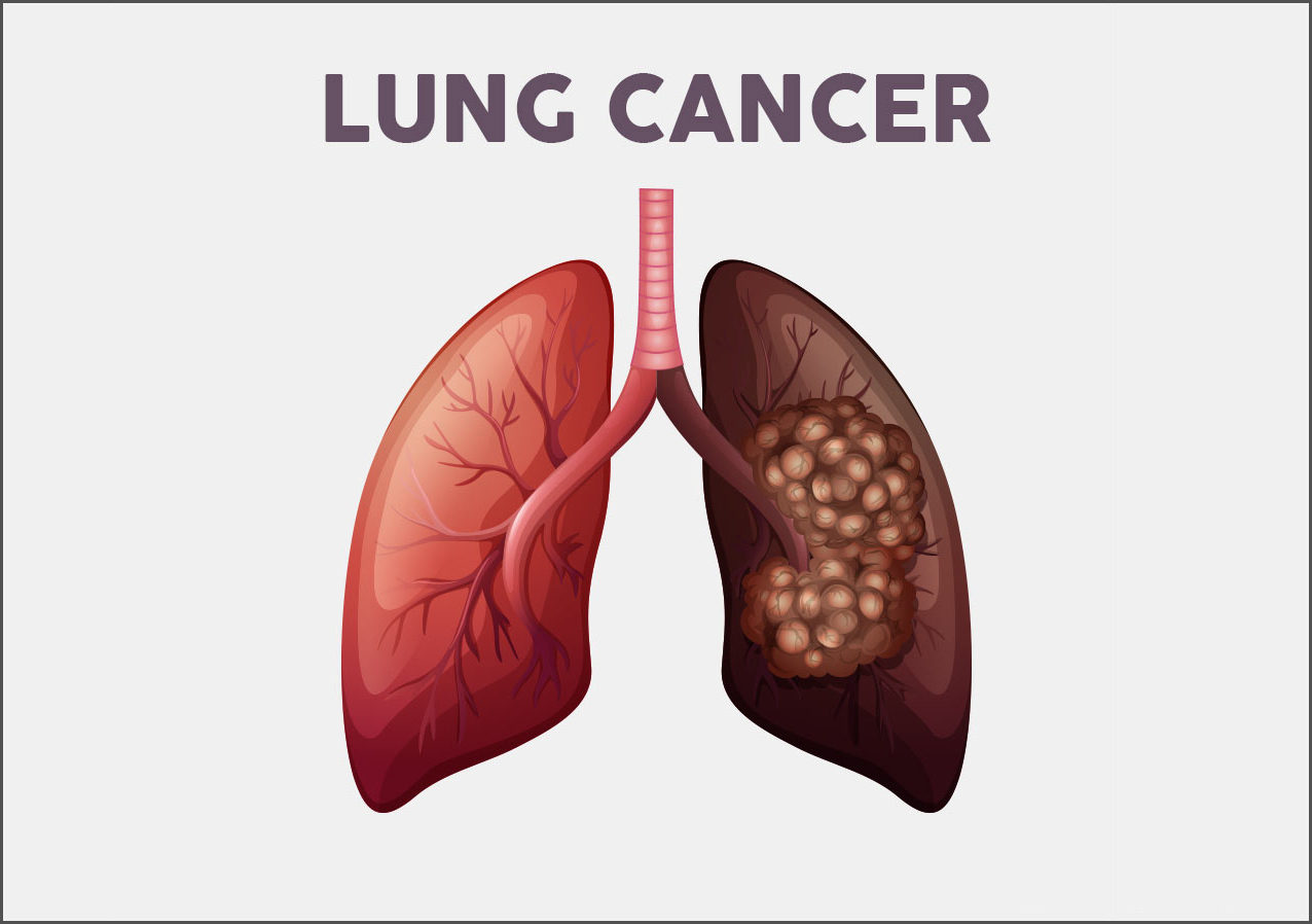 Dr. Rajesh Bollam -Oncologist & Hematologist - Cancer, Lymphoma